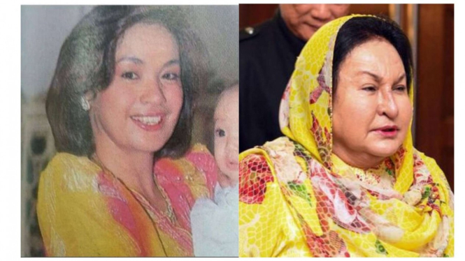 Perbedaan wajah Rosmah Mansor dulu dan sekarang