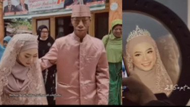 Surya Manurung Pengidap Sindrom Treacher Collins Menikah