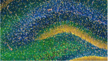 Gambar hippocampus, bagian penting otak untuk pembentukan memori.