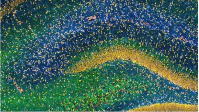 Gambar hippocampus, bagian penting otak untuk pembentukan memori.