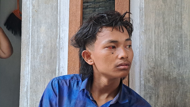 Salah satu Korban tragedi Kanjuruhan adalah M Iqbal Maulana.