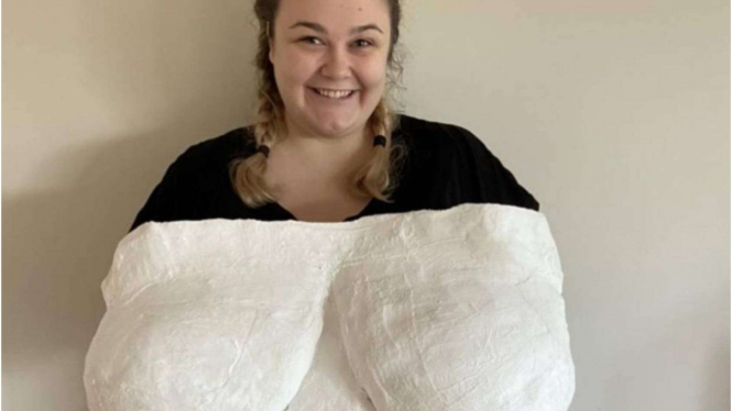 Ellie Nash, wanita dengan dada super besar pasca pengurangan payudara