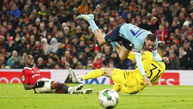 Manchester United vs Burnley
