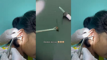 Viral! Di Telinga Wanita Ini Ada Kecoa  