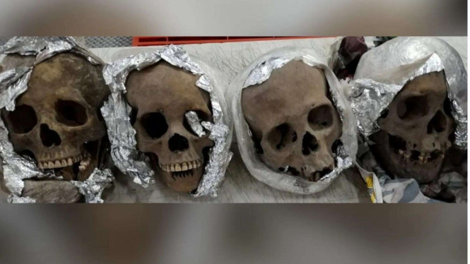 4 tengkorak manusia yang ditemukan di paket.