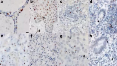 Organ tubuh yang terpengaruh virus SARS-CoV-2. 