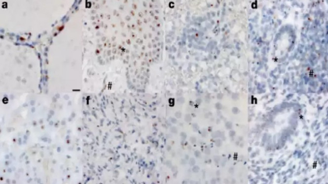 Organ tubuh yang terpengaruh virus SARS-CoV-2. 
