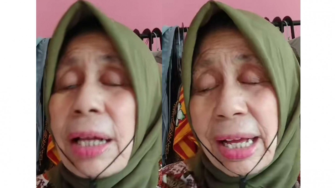 Puspa Sari Dewi yang mengidap penyakit langka 