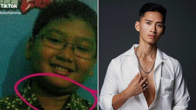Dokter muda Adib Dwitamma dulu dibully, kini bodynya bikin iri dan dipuji