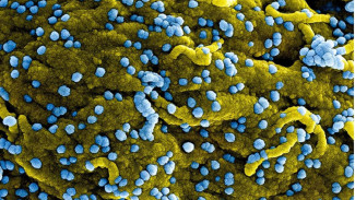 WHO Konfirmasi 9 Kematian Akibat Virus Marburg, Sefatal Ebola?