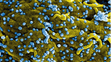 Virus Marburg