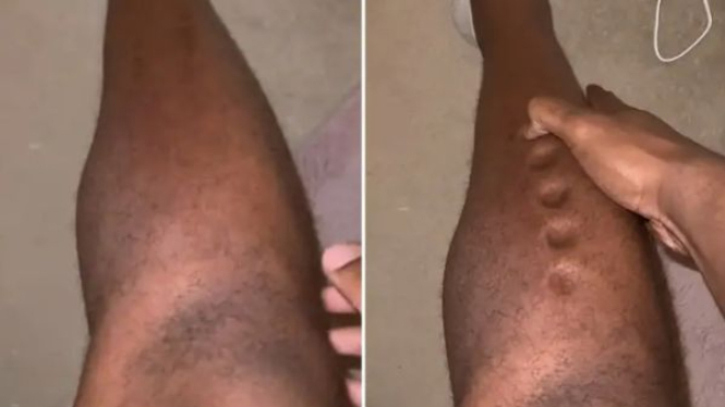 Penampakan kaki Lawrence Okoye