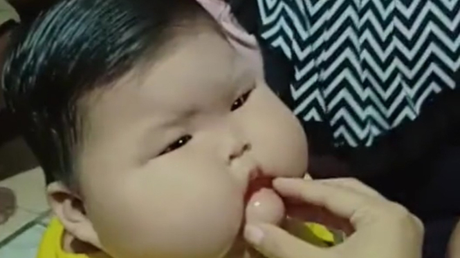 Bayi obesitas, Kenzi.