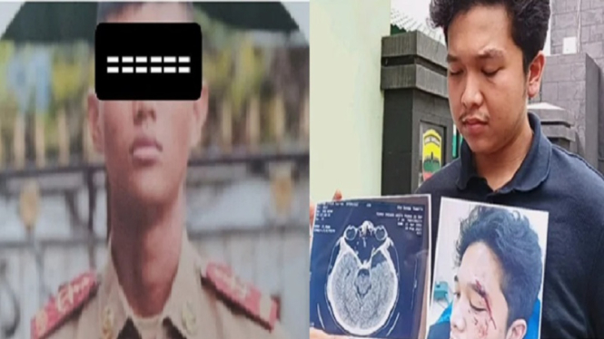 Mahasiswa di Medan melaporkan taruna Akmil ZN terkait kasus penganiayaan