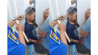 Kepala bocah di Madiun tersangkut di pilar tembok 