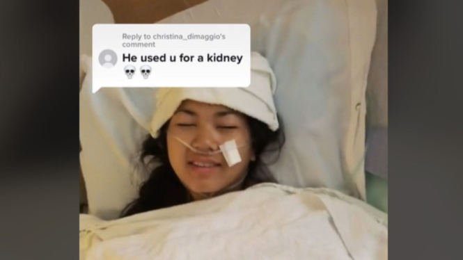 Donor Ginjal untuk Kekasih, Wanita Ini Malah Diselingkuhin