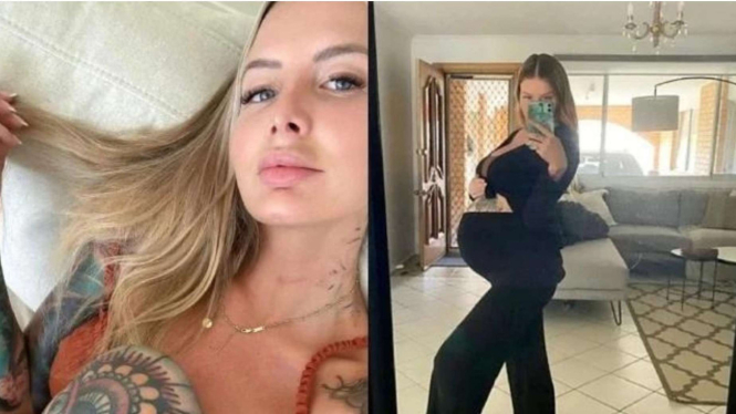 Evelyn Miller, wanita dengan dua vagina