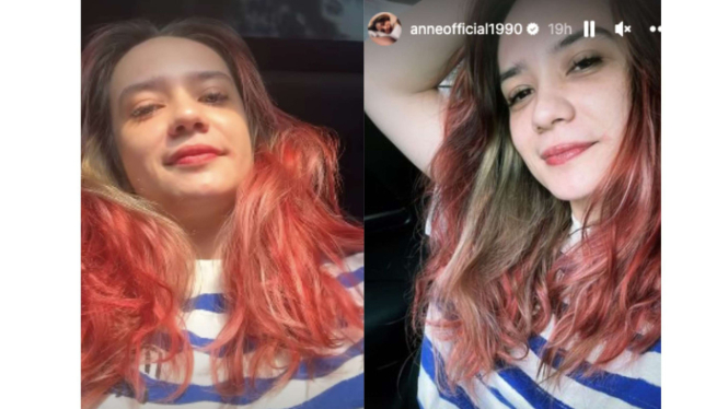 Putri Anne