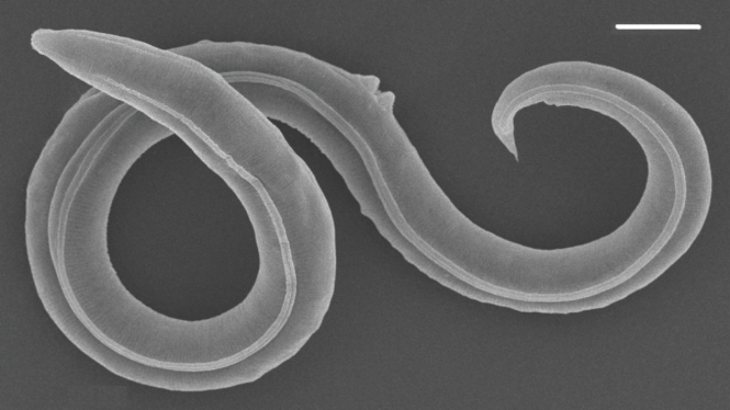 Nematoda Panagrolaimus kolymaensis.