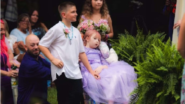 Emma Edwards Penderita Leukemia Menikah Sebelum Meninggal Dunia
