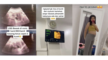Viral wanita hamil divonis hamil kosong tapi pertahankan kehamilannya