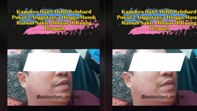 Viral Kapoles Dairi AKBP Reinhard Pukul 2 Anggotanya Hingga Masuk RUmah Sakit