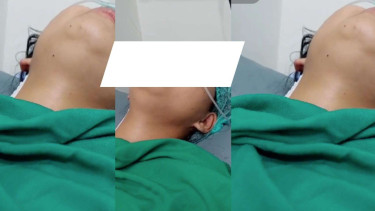 Masih Di Bawah Pengaruh Obat Bius, Wanita Ini Nyanyi Lagu Galau Pasca Operasi
