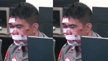 Kisah AIPTU Hasan kecelakaan saat ingin berangkat tes PAG