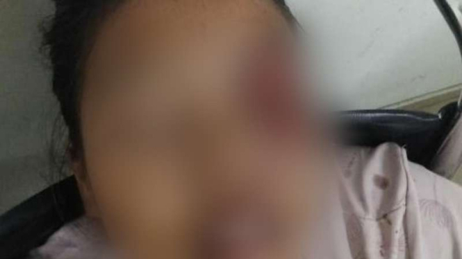 Seorang wanita ditusuk adiknya sendiri karena marah ditagih utang