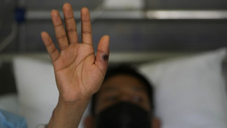 Menkes: Ada 88 Kasus Mpox di Indonesia, Tapi Sudah Sembuh 100 Persen