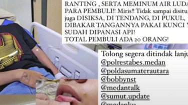 Korban MHD saat menjalani perawatan di rumah sakit.