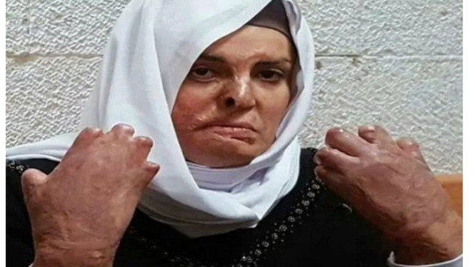 Israa Jaabais