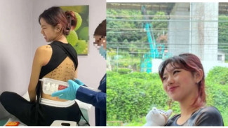 37 Alergi Diderita Wanita Ini, Bagaimana Caranya Hidup?
