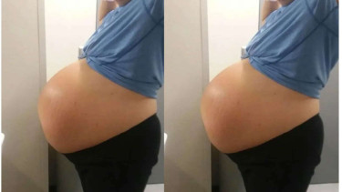 Perempuan Lahirkan Bayi Jumbo