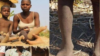 Meet Vadoma Tribe: African People with Ostrich Feet
