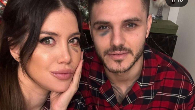 Mauro Icardi dengan mata hitam