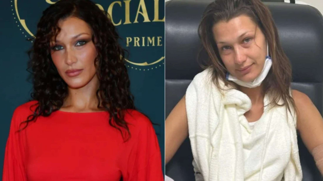 Bikin Kaget! Begini Potret Artis Jika Tampil Tanpa Make Up
