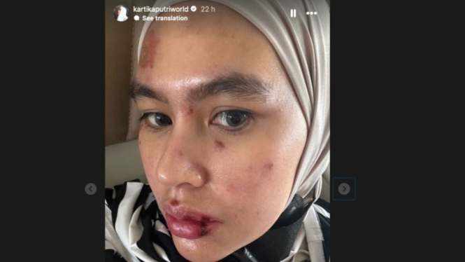 Kartika Putri