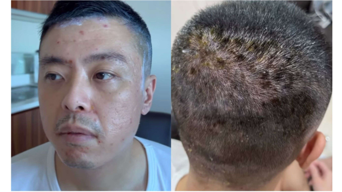 Kapten Vincent kena flu Singapura