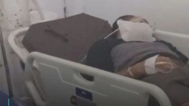 Satu keluarga asal Kabupaten Lahat, Sumatra Selatan, keracunan udara Air Conditioner (AC) mobil saat melaju di Tol Indralaya-Prabumulih pada Minggu 24 Meret 2024. 