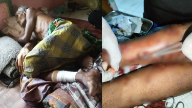 Anmat Komang (62), seorang pria paruh baya warga Desa Tanjung Saleh, Kecamatan Kakap, Kabupaten Kubu Raya mengalami luka serius setelah dirinya diserang buaya muara, pada Kamis 11 April 2024.