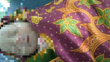 Bayi Perempuan Penuh Luka Gigitan Anjing Ditemukan Dipinggir Jalan Jeneponto