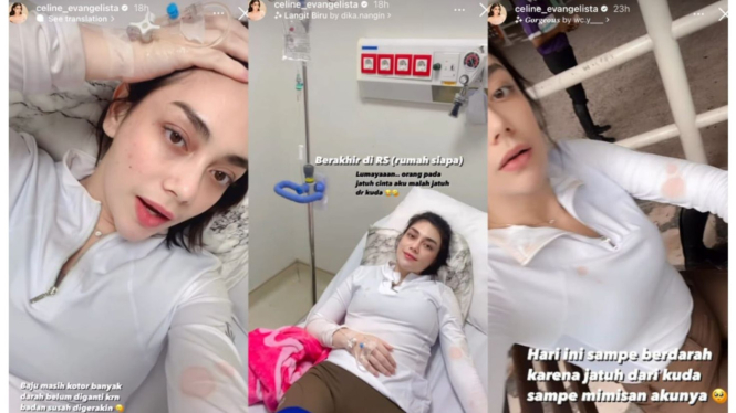 Kondisi Celine Evangelista usai terjatuh saat sedang berkuda
