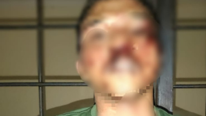 Pelaku curanmor yang dihabisi warga di Tangerang