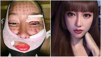 Usai Operasi, Lucinta Luna Bikin Pangling, Netizen: Ini Real?