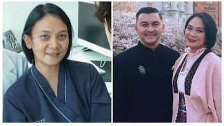 Oplas di Usia 53 Tahun, Dian Nitami Pamer Penampilan Baru: Kerutan Hilang!