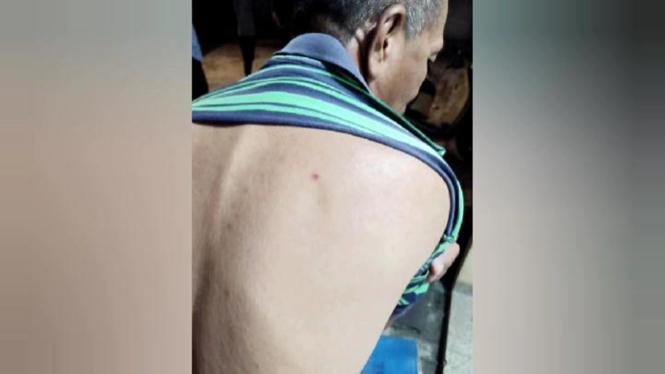 Seorang pria di Bandar Lampung jadi korban peluru nyasar