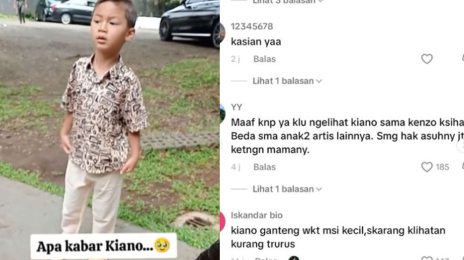 Penampilan Memprihatinkan Kiano Usai di Asuh oleh Baim Wong