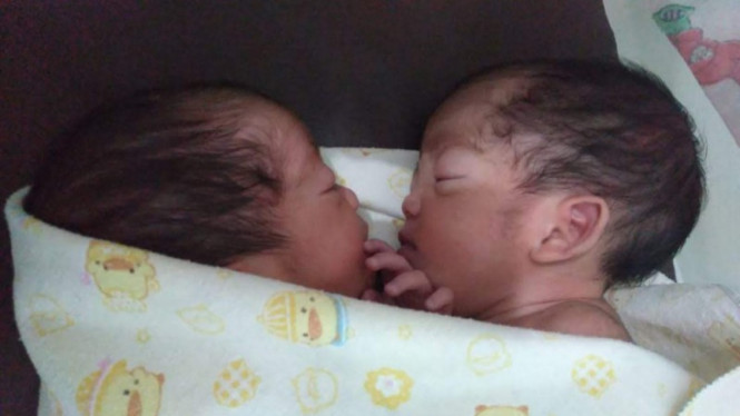 Bayi kembar Annaya Rizka Ramadhani dan Innaya Rizka Ramadhani. (Satria)