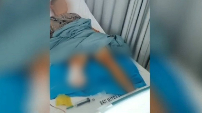 Pasien amputasi diduga malpraktik di Rumah Sakit Mitra Sejati, Medan